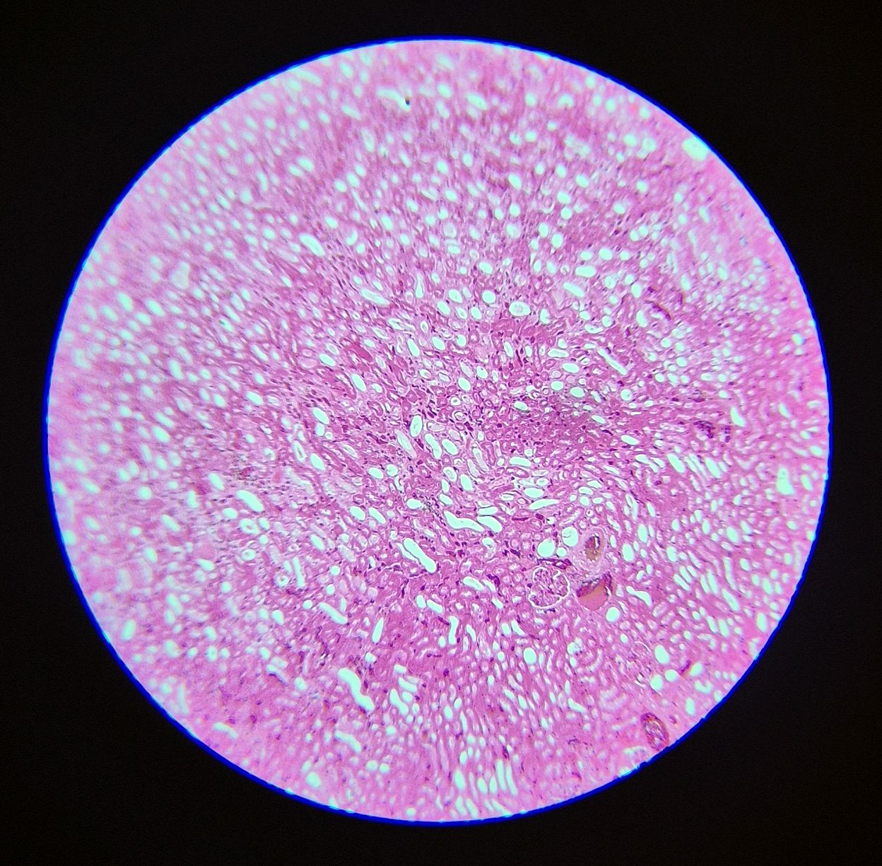 no-87-rein-l-s-kidney-of-l-s